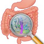 Bacteria in the colon linked to type 2 diabetes
