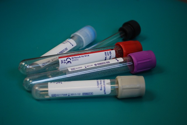A groundbreaking blood test for PTSD A groundbreaking blood test for PTSD