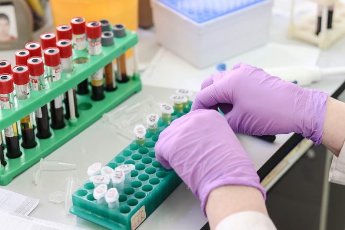 New method to detect early-stage Alzheimer’s New method to detect early-stage Alzheimer’s