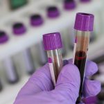 This simple blood test may predict heart attack and stroke