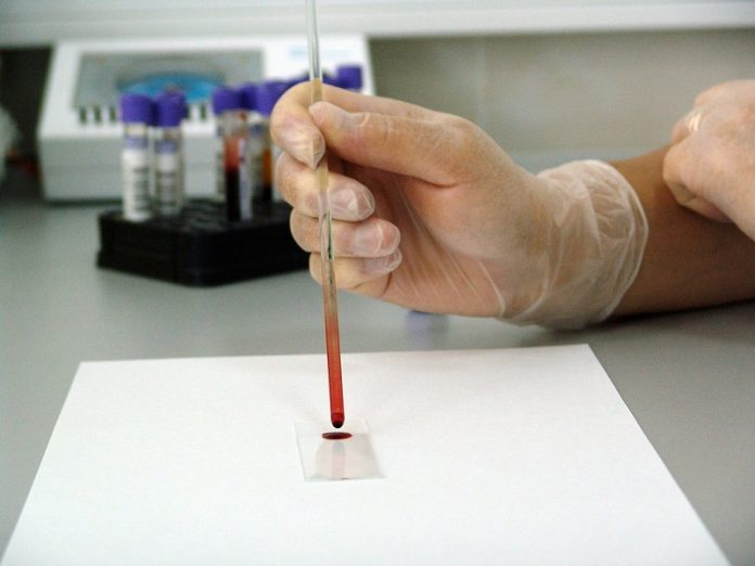 This blood test may help measure pain