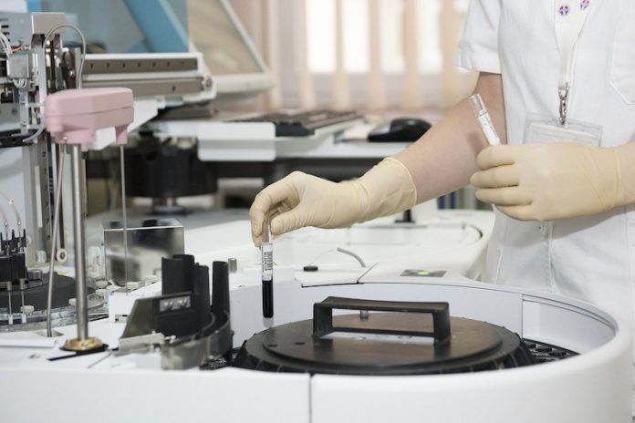 Anal cancer has risen dramatically in American people