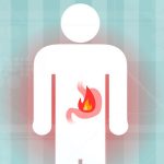 How to handle heartburn during the holidays