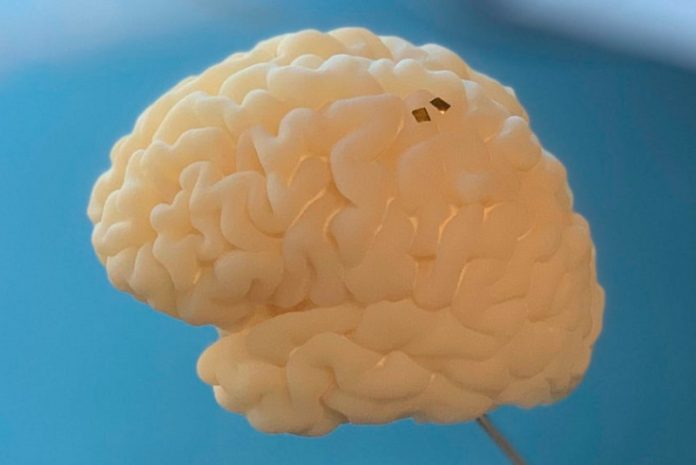 How thoughts could one day control electronic prostheses, wirelessly