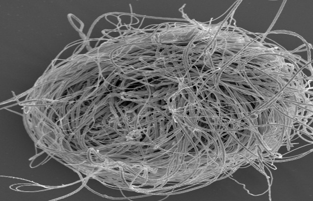 Scientists discover world’s oldest animal sperm in Myanmar amber