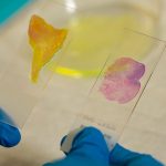 AI-powered microscope could check cancer margins in minutes