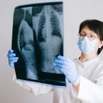 COVID-19 can completely damage lungs, study shows