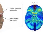 Scientists find a new method to prevent Alzheimer’s disease