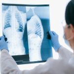 Scientists find hidden damage to lungs in COVID-19