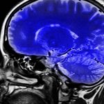 Scientists fine new way to early detect and distinct different forms of dementia