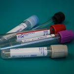This blood infection linked to severe COVID-19