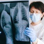 This old drug could prevent lung damage in people with COVID-19