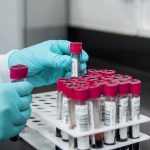 This study finds some root causes of severe COVID-19