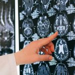 This stuff in the brain may cause Alzheimer’s disease, study finds