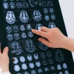 COVID-19 virus does not attack the brain directly