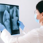 New finding explains severe COVID-19 attacks on the lungs
