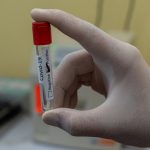 Your immune system mounts a lasting defense after recovery from COVID-19