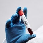 Blood tests can detect severe COVID-19 early