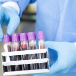 How to avoid blood clots in COVID-19