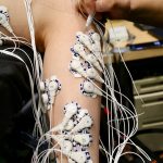 New surgery could help better control prosthetic limbs