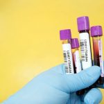 Not all ‘good’ cholesterol is healthy, study finds