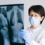 This study finds a big signature of severe COVID-19