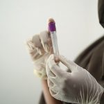 Hormone drugs may help stop severe COVID-19