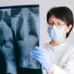 Lung damage in COVID-19 is not caused by immune system overreaction