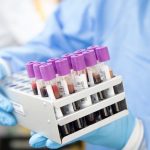 Scientists develop a blood test for depression, bipolar disorder