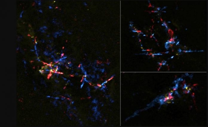 Scientists find baby stars hatch from stellar eggs near galaxy’s center