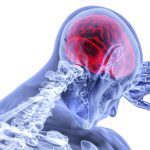 5 critical steps to help prevent a stroke