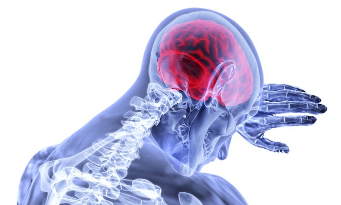 5 critical steps to help prevent a stroke