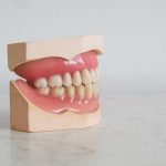 Bleeding gums may be a sign you need more vitamin C in your diet