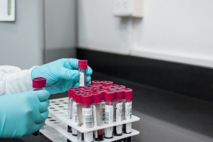 Scientists find cause of blood clots in people with severe COVID-19