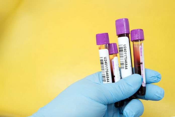This blood test can predict dementia, Alzheimer's risk 5 years early