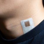 This soft skin patch could provide early warning for strokes, heart attacks