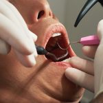 Why gum disease and chronic kidney disease affect each other