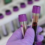 This study finds the cause of blood clots in severe COVID-19