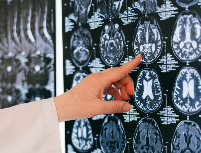 Brown fat can protect the brain from dementia