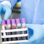Cholesterol should be on everyone’s radar, beginning early in life