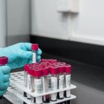 Many people have this ‘silent’ high cholesterol problem but undertreated