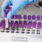 A drop of blood can help detect early-stage lung cancer