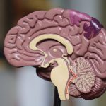 Even small brain lesions linked to cognitive decline