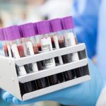 7 things may increase risk of high blood cholesterol