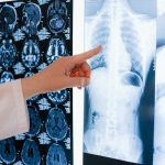 Big risk factors of lung cancer