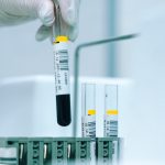COVID-19 linked to high risk of serious blood clots