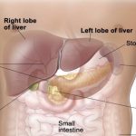 Liver cancer prevention: What you need to know