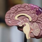 Alzheimer’s disease causes changes in the small blood vessels in the brain
