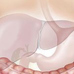 Causes of liver cancer are changing, study finds