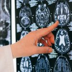 Diabetes and heart disease could increase your dementia risk